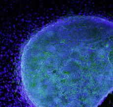 A microscopic view shows a colony of human embryonic stem cells (light blue) growing on fibroblasts (dark blue) in a lab at the California Institute for Regenerative Medicine. By Ho, Reuters A microscopic view shows a colony of human embryonic stem cells (light blue) growing on fibroblasts (dark blue) in a lab at the California Institute for Regenerative Medicine. By Ho, Reuters
