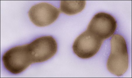 Source: J. Craig Venter Institute Negatively stained transmission electron micrographs of dividing Mycoplasma mycoides JCVI-syn1, a synthesized bacterial genome. Source: J. Craig Venter Institute Negatively stained transmission electron micrographs of dividing Mycoplasma mycoides JCVI-syn1, a synthesized bacterial genome.