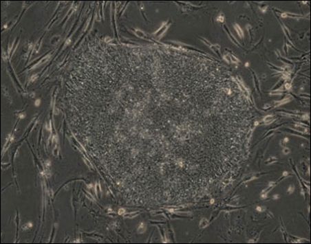 picture: white blood cells. "The scientific team from the University of Wisconsin-Madison created genetic modifications in skin cells (above) to induce the cells into what scientists call a pluripotent state -- a condition that is essentially the same as that of embryonic stem cells." Photo courtesy of Junying Yu, University of Wisconsin picture: white blood cells. "The scientific team from the University of Wisconsin-Madison created genetic modifications in skin cells (above) to induce the cells into what scientists call a pluripotent state -- a condition that is essentially the same as that of embryonic stem cells." Photo courtesy of Junying Yu, University of Wisconsin